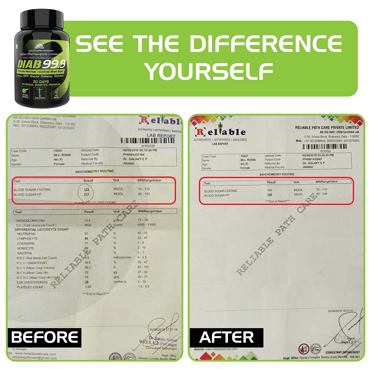 Diab 99.9 Type-2 Ayurvedic Sugar Reversal Program | Get Free Doctor & Dietitian Reversal Consultation | 100% Natural Health Care > Metabolic Health > Diabetes > Supplement > Ayurvedic Diabetes Reversal The Yoga Man Lab   