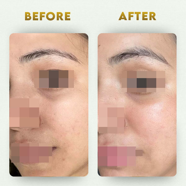 YogaManLab® Multani Mitti Glow Face Pack – For Deep Pore Cleansing, Acne Defense & Tan Removal (With Chandan, Turmeric & Orange Peel)