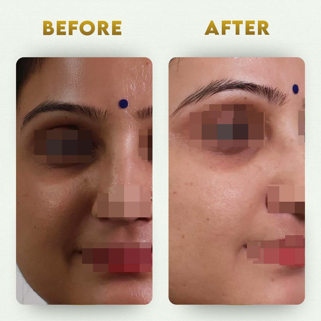 YogaManLab® Multani Mitti Glow Face Pack – For Deep Pore Cleansing, Acne Defense & Tan Removal (With Chandan, Turmeric & Orange Peel)