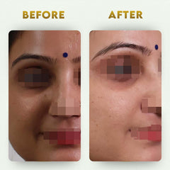 पेट साफ करने वाला किट- आंतों का विषहरण + दैनिक सफाई करने वाला (2 आयुर्वेदिक पूरक) | कब्ज से राहत देता है और आंतों को साफ करता है | 100% प्राकृतिक