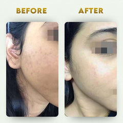 पेट साफ करने वाला किट- आंतों का विषहरण + दैनिक सफाई करने वाला (2 आयुर्वेदिक पूरक) | कब्ज से राहत देता है और आंतों को साफ करता है | 100% प्राकृतिक