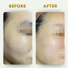 पेट साफ करने वाला किट- आंतों का विषहरण + दैनिक सफाई करने वाला (2 आयुर्वेदिक पूरक) | कब्ज से राहत देता है और आंतों को साफ करता है | 100% प्राकृतिक