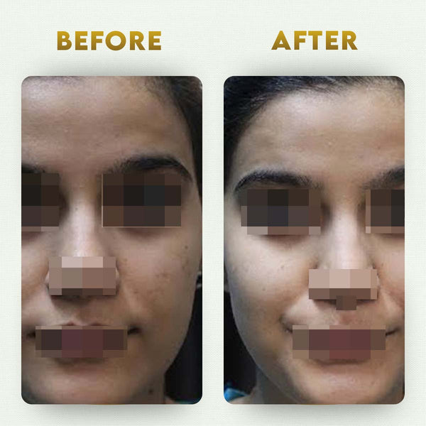 YogaManLab® Multani Mitti Glow Face Pack – For Deep Pore Cleansing, Acne Defense & Tan Removal (With Chandan, Turmeric & Orange Peel)