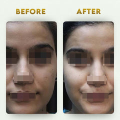 पेट साफ करने वाला किट- आंतों का विषहरण + दैनिक सफाई करने वाला (2 आयुर्वेदिक पूरक) | कब्ज से राहत देता है और आंतों को साफ करता है | 100% प्राकृतिक