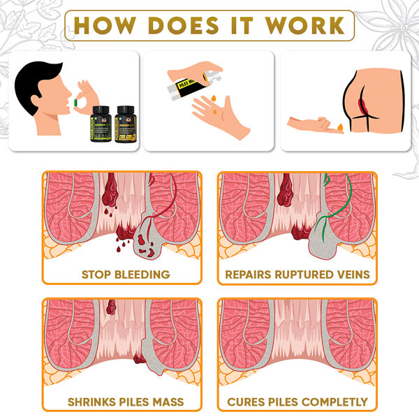 YogaManLab® PILES MATRIX - Ayurvedic Kit | Hemmorhoids Internal & Topical Support Kit with Herbal Remedies Diet Booklet | 100% Natural