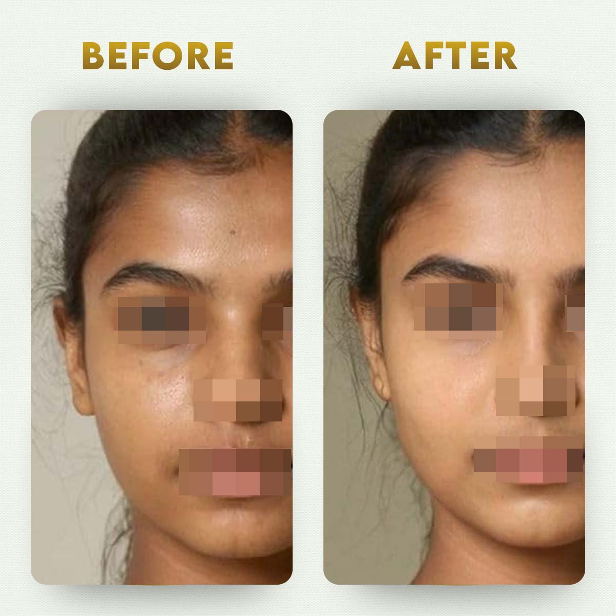 YogaManLab® Glutathione Skin Whitening Kojic Acid Soap | Makes Skin Bright & Glowing | Glutathione, Chandan, Haldi, Kesar, Sandal Wood and Saffron Soap | For Men & Women Skin