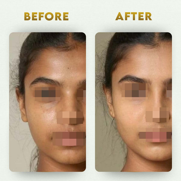 YogaManLab® Glutathione Skin Whitening Kojic Acid Soap | Makes Skin Bright & Glowing | Glutathione, Chandan, Haldi, Kesar, Sandal Wood and Saffron Soap | For Men & Women Skin