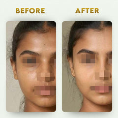 YogaManLab® Glutathione Skin Whitening Kojic Acid Soap | Makes Skin Bright & Glowing