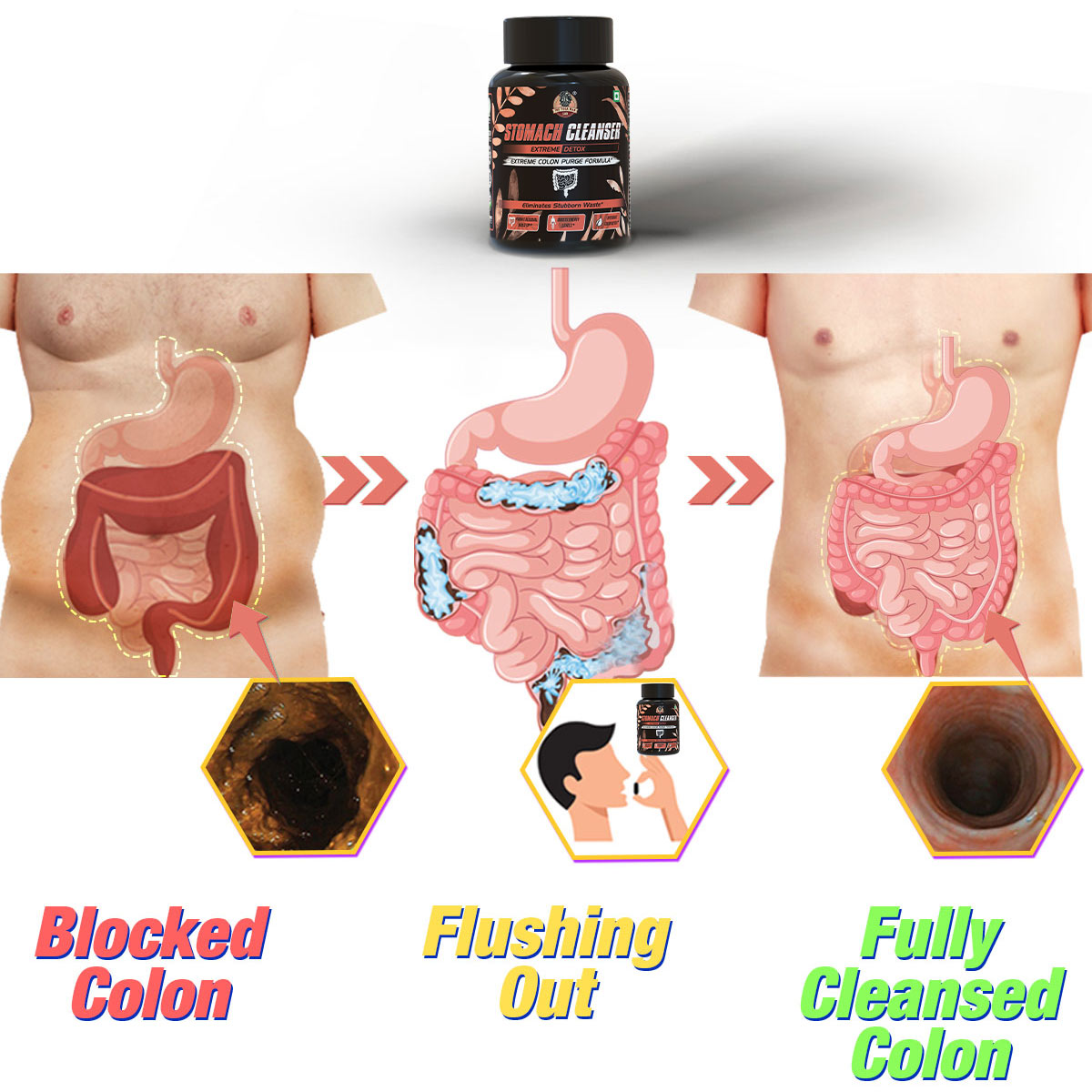 YogaManLab® STOMACH CLEANSER- Extreme Detox Ayurvedic Supplement | For People With Delayed Motion & Hard Stool | 100% Natural