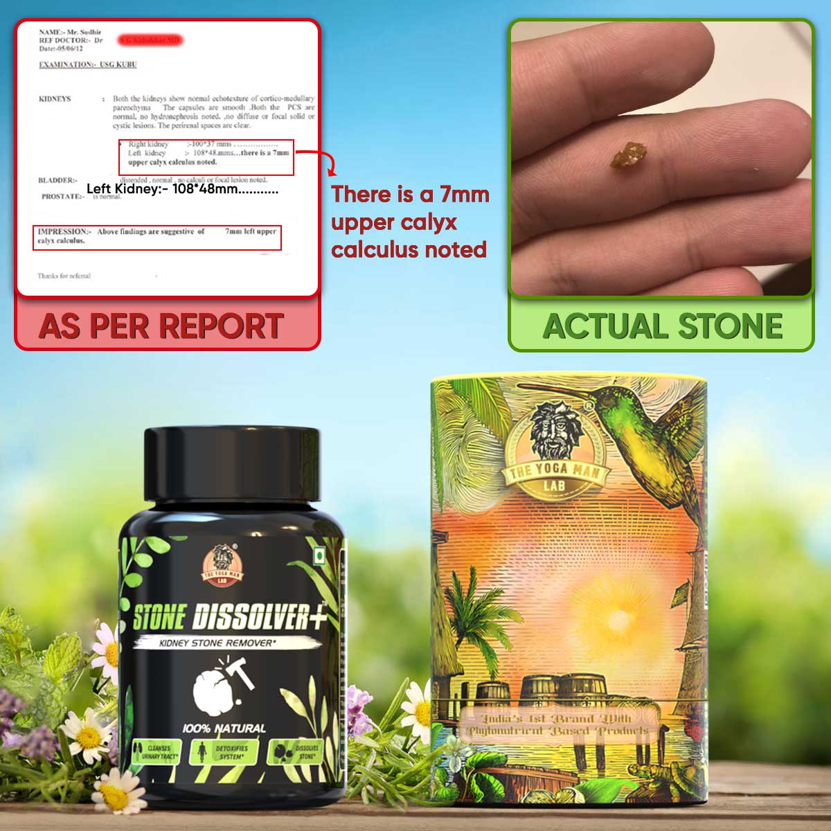 YogaManLab® STONE DISSOLVER+ - Stone Remover Ayurvedic Supplement | 100% Natural & Plant Based