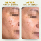 YogaManLab® 10% Pure Vitamin-C & 0.5% Ferulic Acid Face Serum | Brightens Dull Skin, Evens Tone
