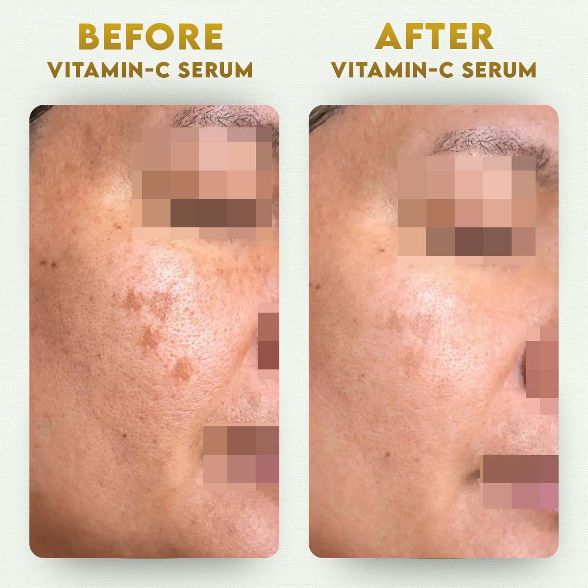 YogaManLab® 10% Pure Vitamin-C & 0.5% Ferulic Acid Face Serum | Brightens Dull Skin, Evens Tone