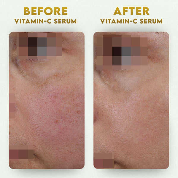 YogaManLab® 10% Pure Vitamin-C & 0.5% Ferulic Acid Face Serum | Brightens Dull Skin, Evens Tone