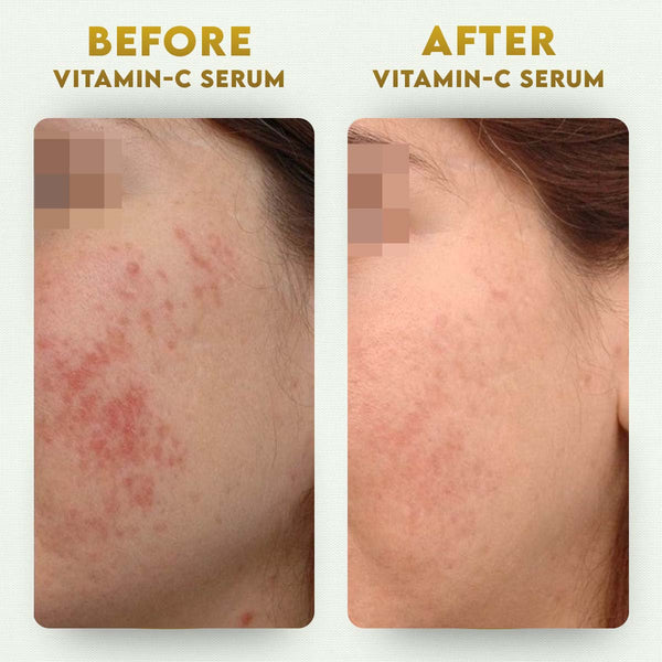 YogaManLab® 10% Pure Vitamin-C & 0.5% Ferulic Acid Face Serum | Brightens Dull Skin, Evens Tone
