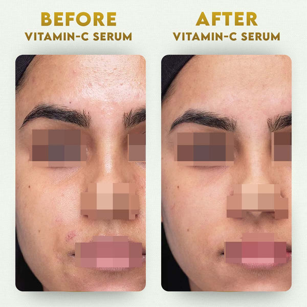 YogaManLab® 10% Pure Vitamin-C & 0.5% Ferulic Acid Face Serum | Brightens Dull Skin, Evens Tone