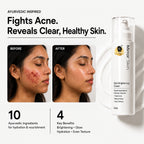 YogaManLab® Mirror Skin Cream | Dark Spots, Acne Marks & Pigmentation | Glass Skin Glow | 15ml