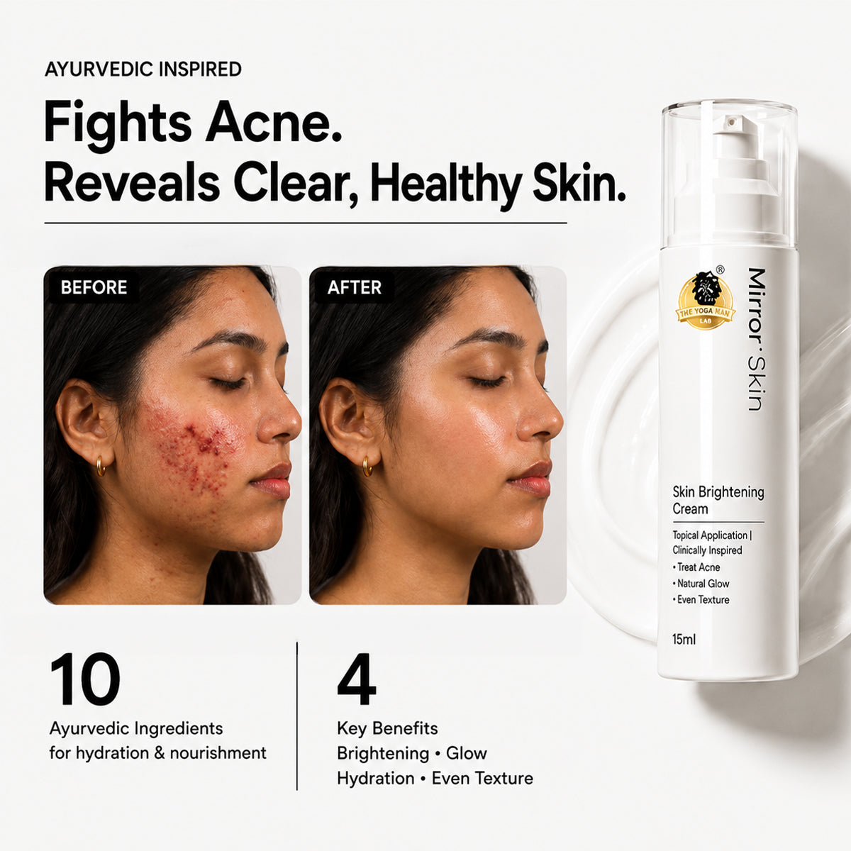 YogaManLab® Mirror Skin Cream | Dark Spots, Acne Marks & Pigmentation | Glass Skin Glow | 15ml