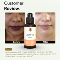 YogaManLab® 10% Vitamin-C & Ferulic Acid Face Serum | Non-Irritating & Non-Sticky | Tested for Oily, Sensitive Skin | Beginner-Friendly| Brightens Dull Skin, Evens Tone | No Purging | With 0.5% Ferulic Acid