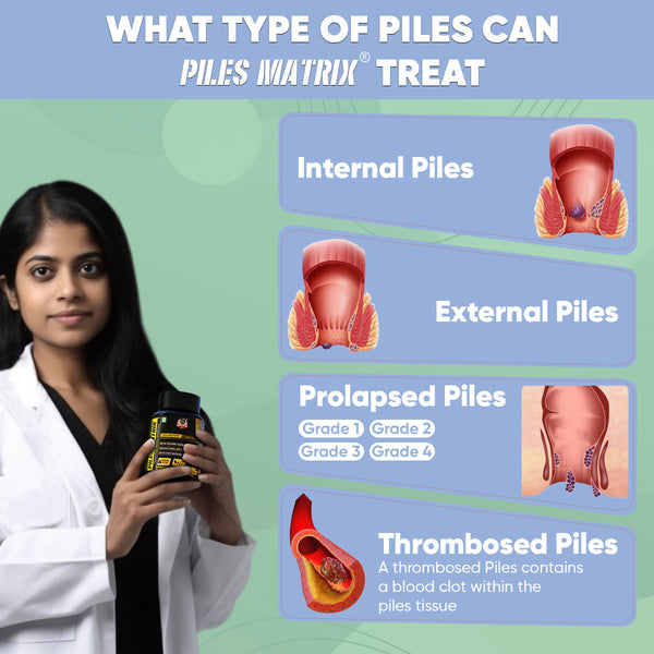 YogaManLab® PILES MATRIX - Piles Treatment Ayurvedic Capsules & Lepam Ointment | With Free Diet & Doctor | Treats Internal Grade1-4 & External Hemorrhoids | 100% Natural