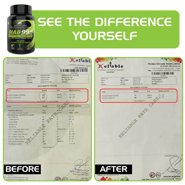 YogaManLab® DIAB 99.9 Type-1 Sugar Ayurvedic Supplement | For Natural Pancreatic Secretion & Side-Effect Prevention | 100% Natural