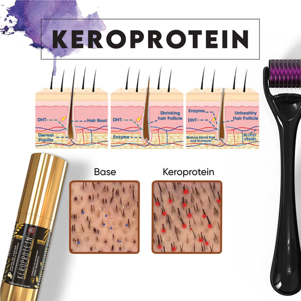 KEROPROTEIN प्लांट हेयर ग्रोथ थेरेपी किट (महिला) | टॉपिकल हेयर ग्रोथ ऑयल (30ml) + केरोनीडल (0.5mm) शामिल है