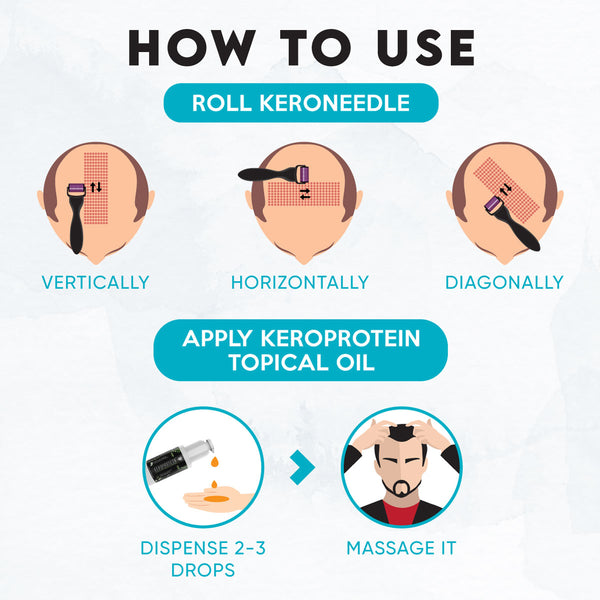 YogaManLab® KEROPROTEIN Plant Hair Growth Therapy Kit (Women) | Includes Topical Hair Growth Oil (30ml) + Keroneedle (0.5mm)