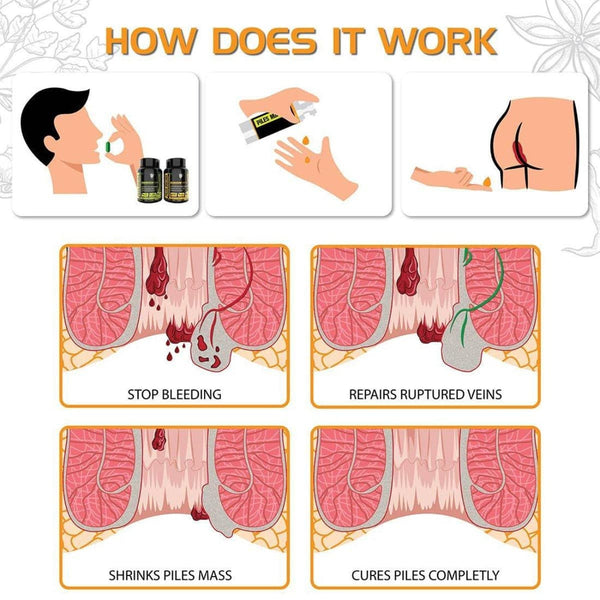 YogaManLab® Piles Matrix - वेन रिस्टोर + रेक्टम रिस्टोर+ डाइट बुकलेट